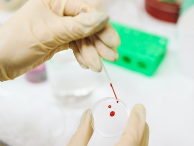 हेमाटोलोजी सेवा